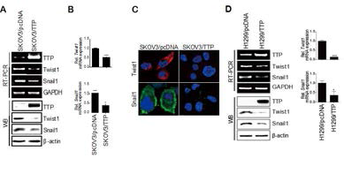 TTP에 의한 Twist1 발현 억제