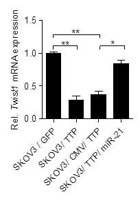TTP 과발현 신경교종세포주에서 miR-21이 Twist1 발현 조절에 끼치는 영향