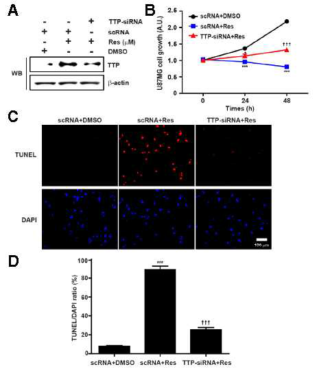 TTP 발현 감소에 의한 Res 항암효과 영향