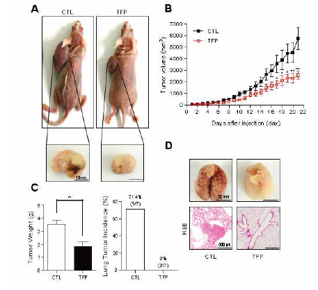 TFP에 의한 생체내 암 성장 및 전이 억제