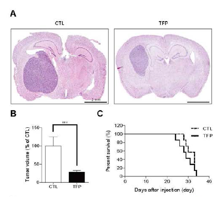TFP에 의한 뇌암 성장 억제 및 생존기간 중가