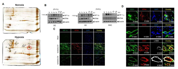 종양미세환경 유래 혈관줄기세포 활성 조절 신규 바이오마커, Netrin-4 발굴 및 발현 분석