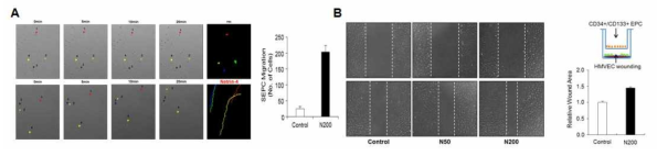 Netrin-4에 의한 혈관줄기세포 동원 및 paracrine 효능 분석 I(이동성 촉진)