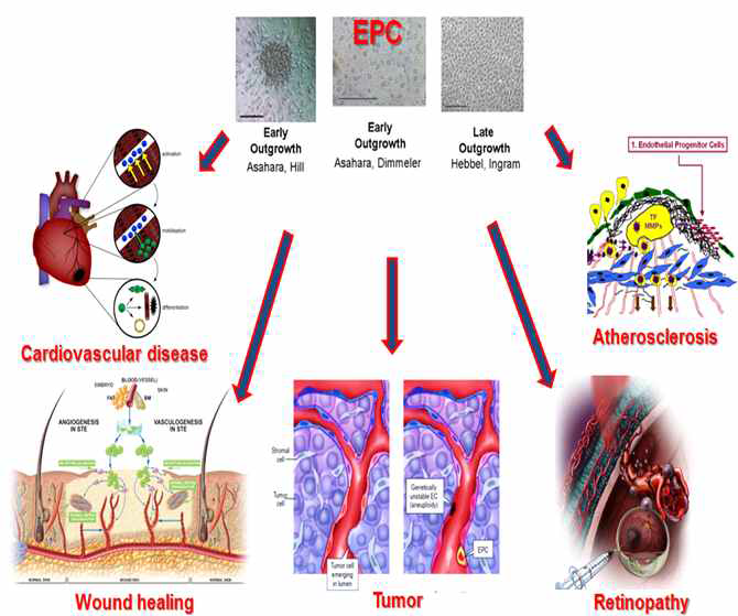 EPC의 생리병리학적 기능