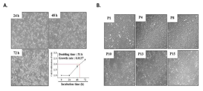 Neural precursor cell (미분화) 단계에서의 hESC-derived hNPCPSA-NCAM+의 세포 증식률(A) 및 배양 단계에 따른 형태학적 변화(B) 확인