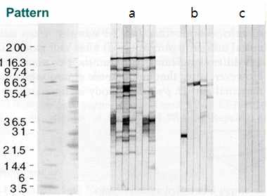 Western blot patterns