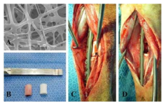 SEM images of electrospun PLGA/HAp nanofibers (A), the normal radius (left) and a three-dimensional PLGA/HAp nanofiber (right) (B), an intraoperative view of a radius defect. Three-dimensional PLGA/HAp nanofiber with gelatin of radius defect (arrow) (C) and a 15 mm-long region of radius (D).