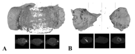 Representative micro-CT reconstruction 3D images 18 weeks after surgery. 3D PLGA/HAp nanofibrous scaffolds with gelatin (A), control group (B)