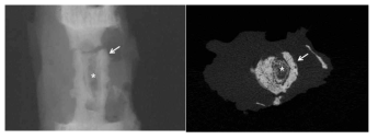 Representative micro-CT reconstruction images 36 weeks after surgery. Outer layer in nanofibrous scaffolds (arrow) and inter layer in nanofibrous scaffolds (star)