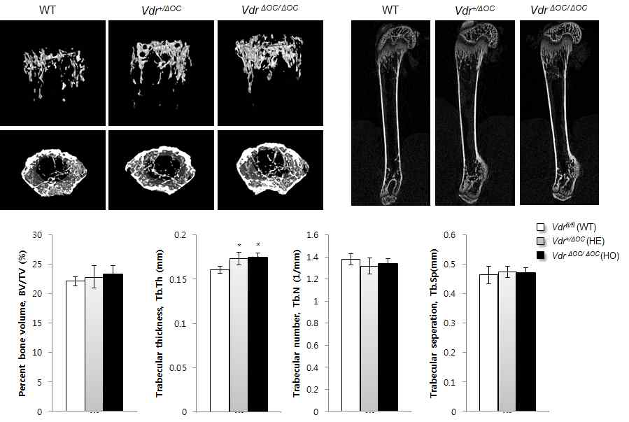 4주령된 VdrΔoc/Δoc뼈의 표현형 분석 *p<0.05