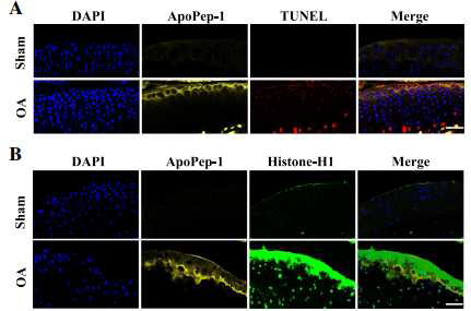 ApoPep-1을 이용한 골 관절염 관절연골 조직형광염색