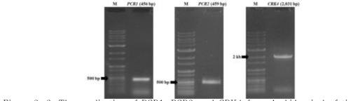 The amplication of PCR1, PCR2, and CRK4 from Arabidopsis leaf tissue
