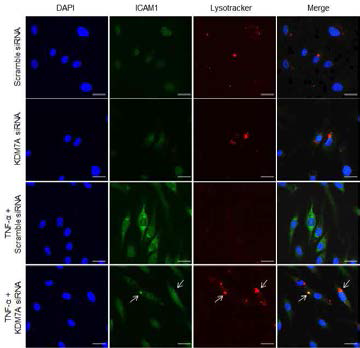 TNF-α 및 KDM7A에 의해 조절되는 lysosome formation