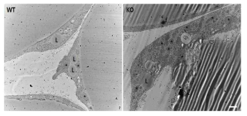 정상 생쥐와 AHNAK 결손 생쥐의 지방세포 (adipocyte) 형태 비교