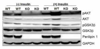 Plin1 유전자가 결핍된 백색지방에서의 인슐린 신호전달 수준 감소