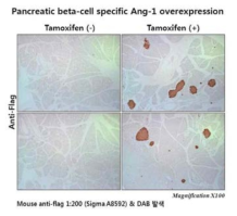 Pancreatic beta-cell 특이적인 Ang-1 과발현