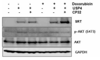 Doxorubicin으로 인한 AKT 인산화 유도시 USP4와 CP32에 의한 효과 확인