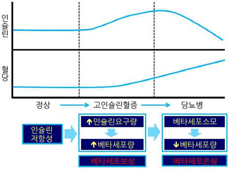 당뇨병의 병태생리기전