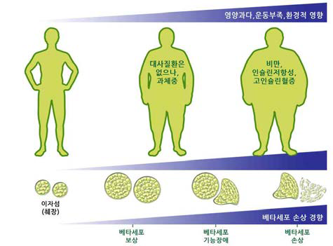 제 2형 당뇨병의 발병 기전