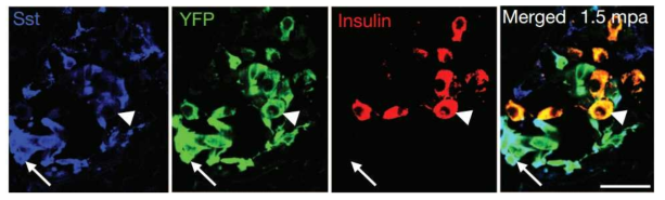 Sst-Cre; R26-YFP; RIP-DTR mice에서 doxycyclin 투여 1.5개월 후 췌도 사진.