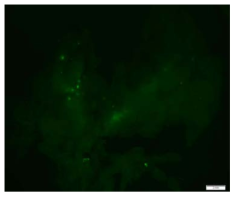 MIP-Cre 췌장에서 Cre recombination에 의한 GFP 발현. Scale bar 2mm