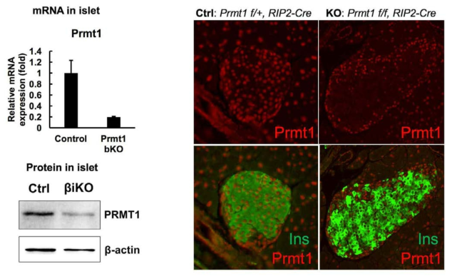 PRMT1 βKO, βiKO 마우스에서 베타세포 특이적으로 PRMT1이 KO되었음을 확인함.