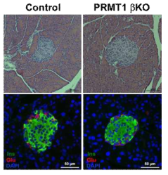 6주령 PRMT1βKO 췌도의 구조 및 베타, 알파세포 비율