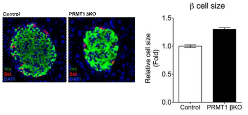 6주령 PRMT1 βKO 마우스 베타세포의 평균적인 크기 비교