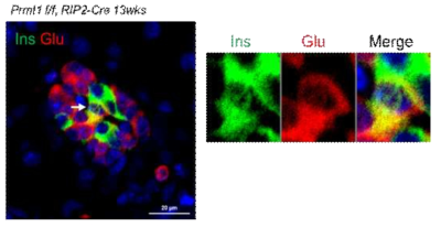 13주령의 PRMT1 βKO 마우스 췌도에서 관찰되는 insulin/glucagon co-positive cell.