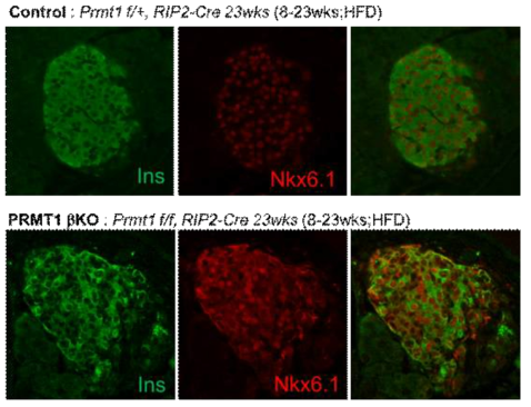 고령, 고지방식이 섭취 PRMT1 βKO 마우스 췌도의 Nkx6.1 발현패턴