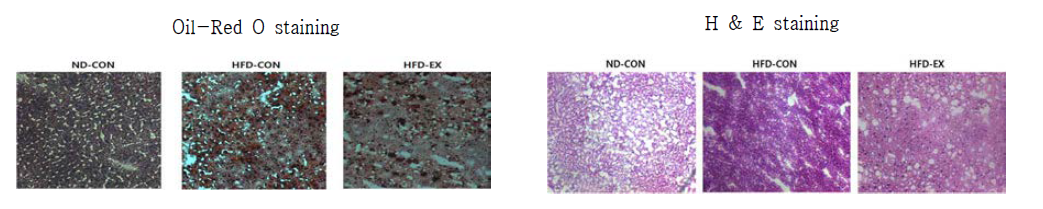 Effects of exercise training on liver histology.