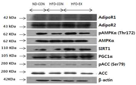 Effects of exercise training on energy sensor proteins in the liver