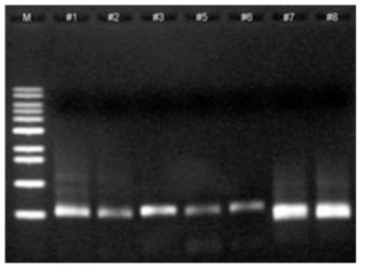 PCR로 증폭된 amplicon DNA 밴드