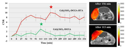 서로 다른 리간드로 수식된 가돌리늄 나노 입자의 암세포 조영 증강 비교 MR 사진.