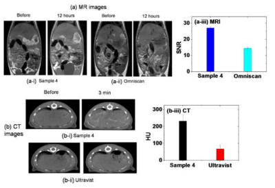 상용화된 MRI 조영제 및 상용화된 CT 조영제와 조영효과 비교