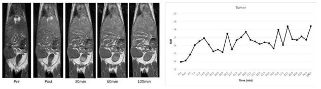 가돌리늄이 표지된 덱스트란 나노입자의 CT26 종양 모델에서의 T1 강조 MR 영상