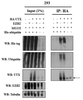 세포 내 UTX 단백질의 유비퀴틴화(ubiquitylation) 분석