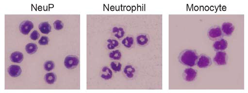 May-Grunwald Giemsa 염색법을 통한 호중구 전구세포의 분석