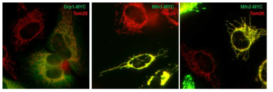 Drp1, Mfn1, Mfn2 과발현 시 활력체 역동성 변화 (Tom20; 활력체 표지 단백질)