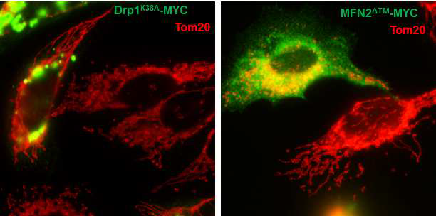 Drp1K38A, Mfn2△TM 과발현시 활력체 역동성 변화 (Tom20; 활력체 표지 단백질)