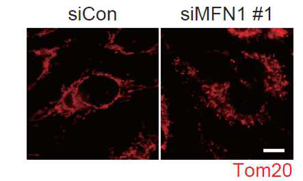 Mfn1 knockdown시 활력체 역동성 변화 (Tom20; 활력체 표지 단백질)