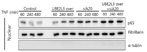 TNF-α 처리 후 TNFAIP3 감소와 UBE2L3 증가에 따른 HEK293 세포핵 내 p65 양 변화