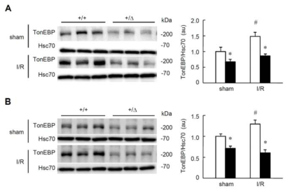 Renal TonEBP expression after ischemia/reperfusion (I/R) or sham treatment in TonEBP+/Δ (+/Δ, filled bars) mice and their TonEBP+/+ littermates (+/+, open bars).