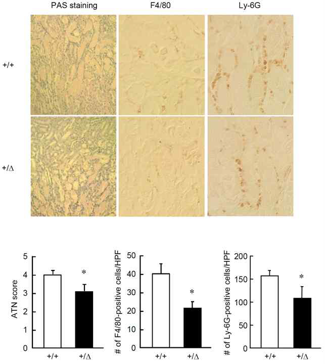 Renal tissues were obtained from TonEBP+/Δ (+/Δ, filled bars) mice and their TonEBP+/+