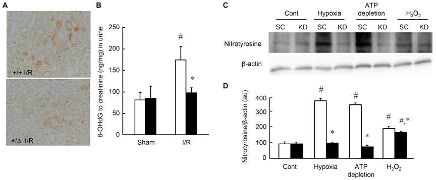 Effects of TonEBP deficiency on oxidative stress in kidneys and HK-2 cells.