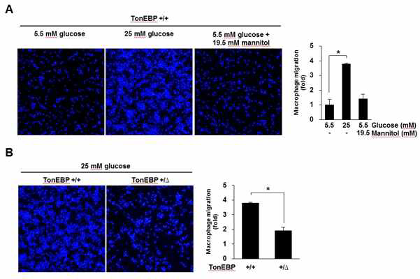 High glucose-induced macrophage migration is defective in TonEBP deficiency.