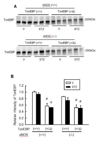 Renal expression of TonEBP in experimental animals.