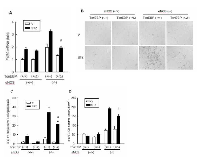 Reduced macrophage infiltration of the kidney in TonEBP deficiency.