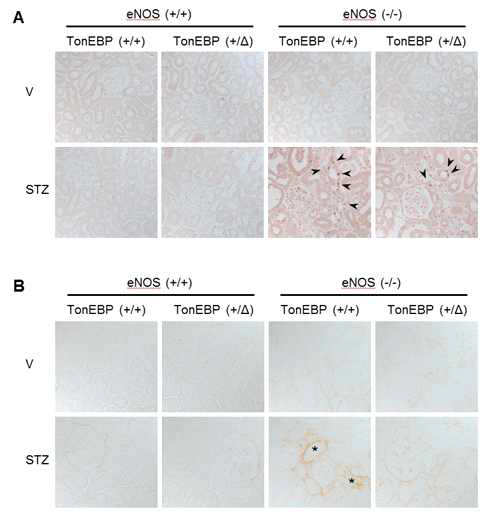 Reduced renal STAT3 phosphorylation and TGF-β expression in TonEBP deficiency