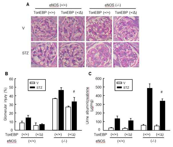 Reduced glomerular injury and albuminuria in TonEBP deficiency.